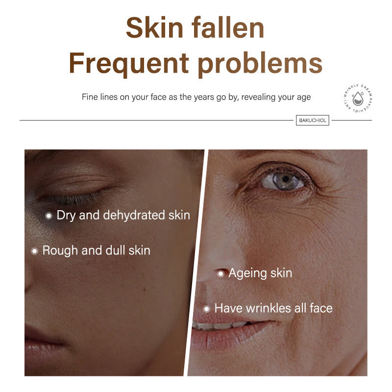 All English Fructus Psoraleae Phenol Wrinkle Lift Cream Fading Wrinkle Acne Mark Control Acne Firming Cream